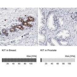 CD117/c-kit Antibody, Novus Biologicals 25 &mu;L | Buy Online | Novus Biologicals | Fisher Scientific